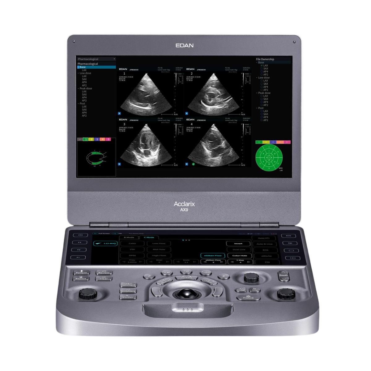 Edan Acclarix AX9 Vet 1