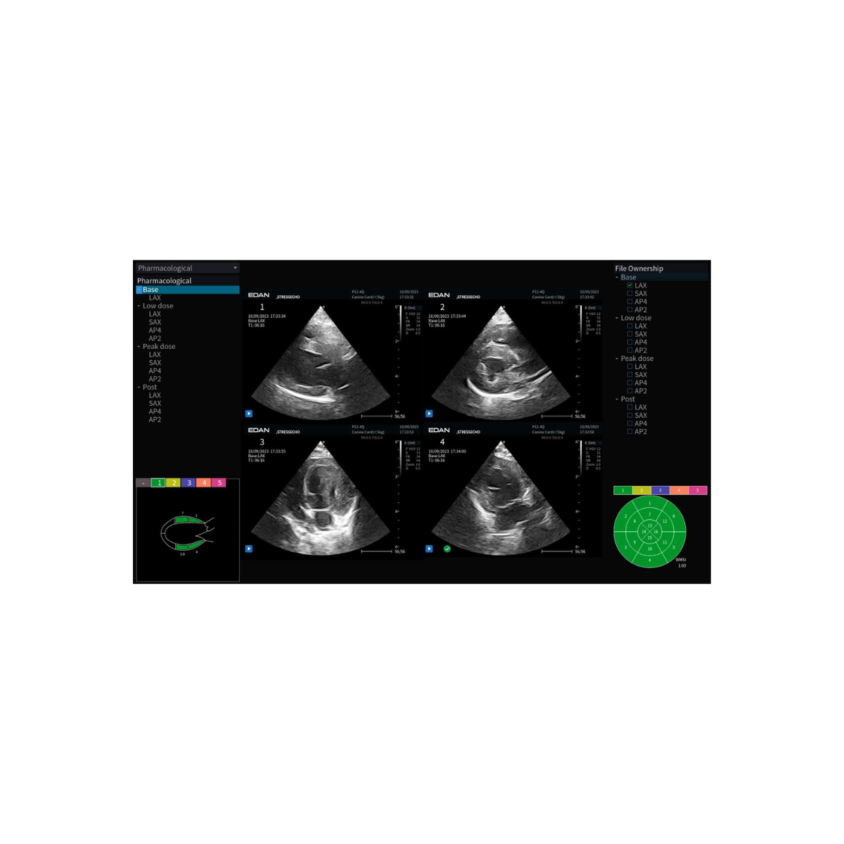 Edan Acclarix AX9 Vet 5
