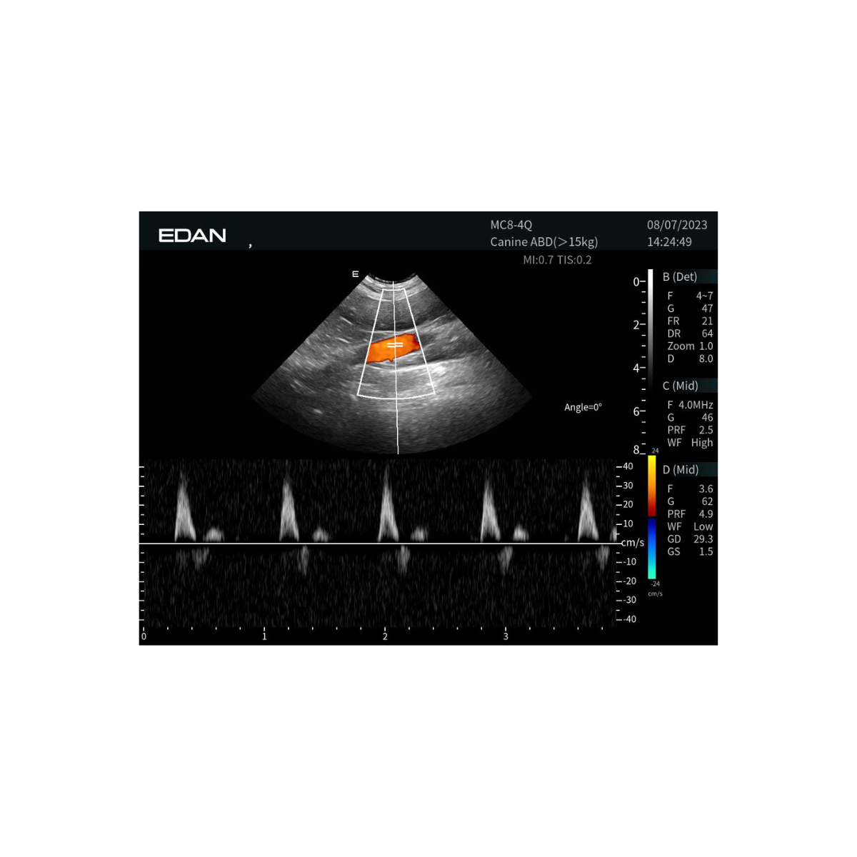 Edan Acclarix LX3 Vet 6
