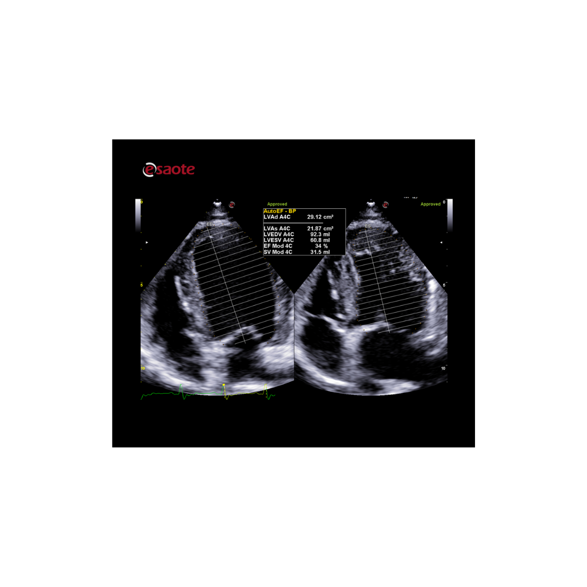 Esaote MyLab™X90 Vet 6